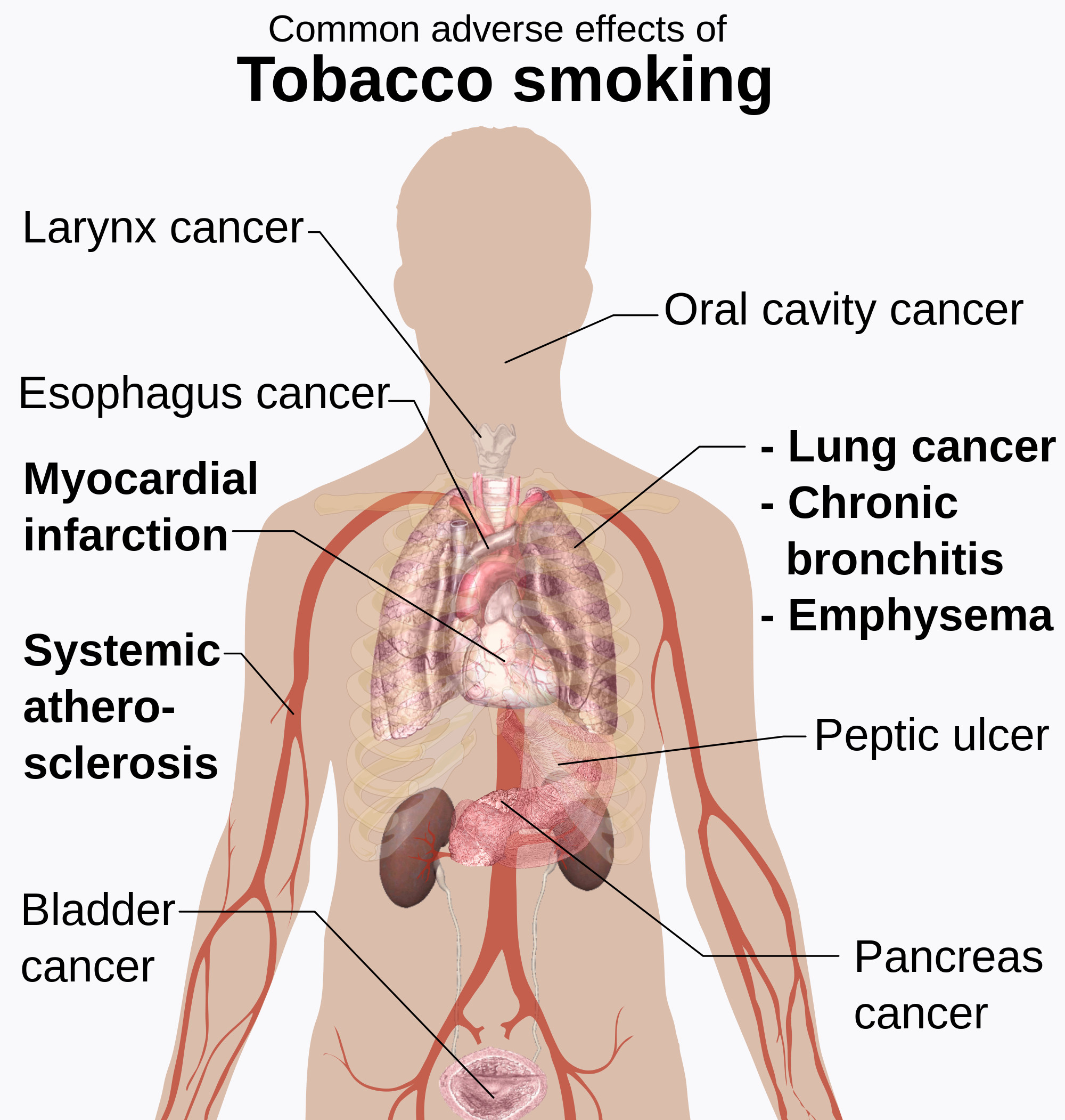 Adverse_effects_of_tobacco_smoking